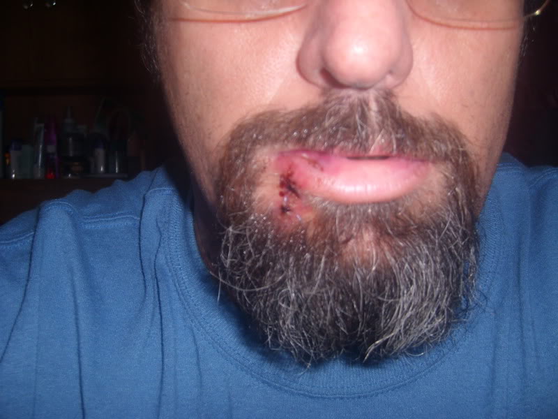 ai133.photobucket.com_albums_q65_Lizooki_SL730819.jpg