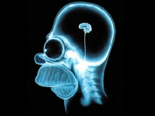 amrbarlow.files.wordpress.com_2008_02_homer_simpson_brain.jpg