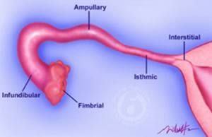 awww.tubal_reversal.net_images_anatomy_fallopian_tube.jpg