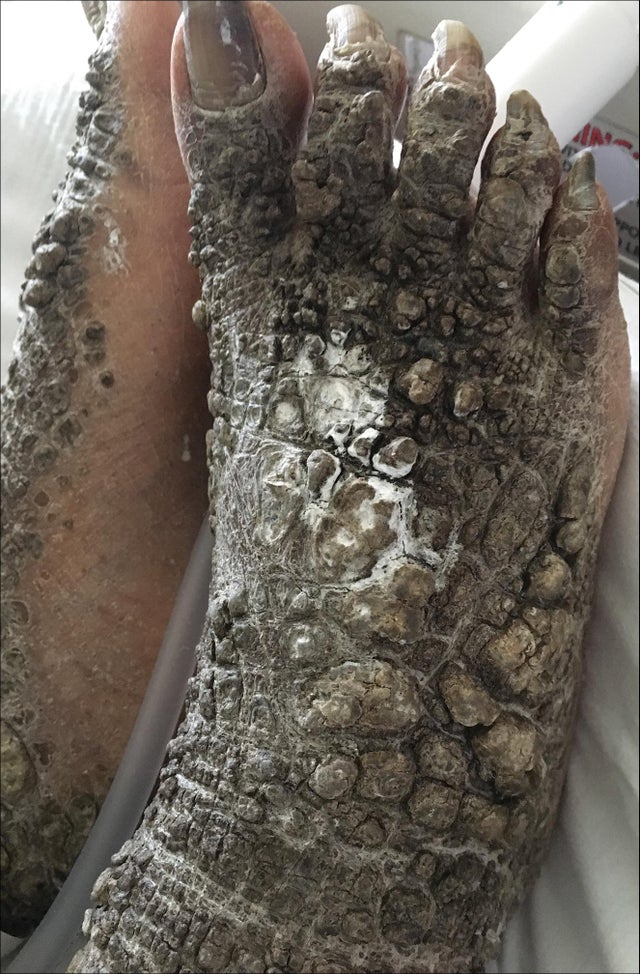feet gators.jpg