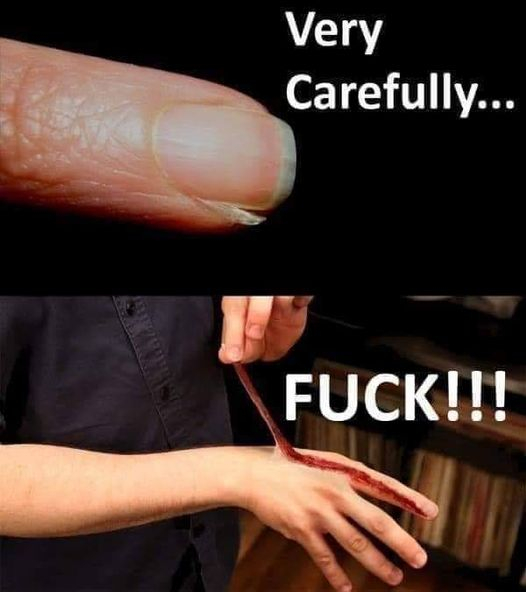 hang nail..jpeg