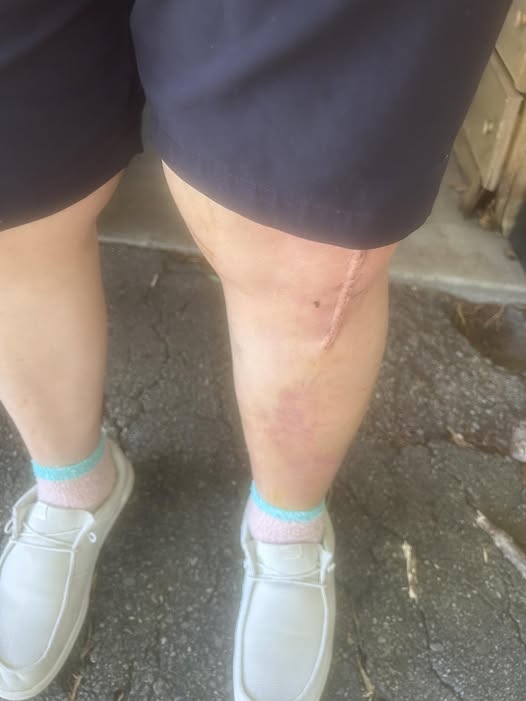 knee 2.jpg