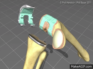 knee gif.gif
