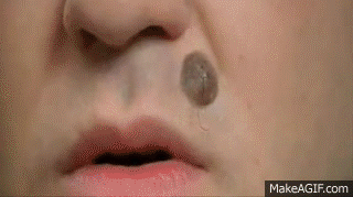 molegif.gif