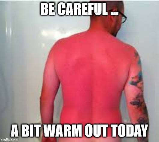 sunburn.jpg