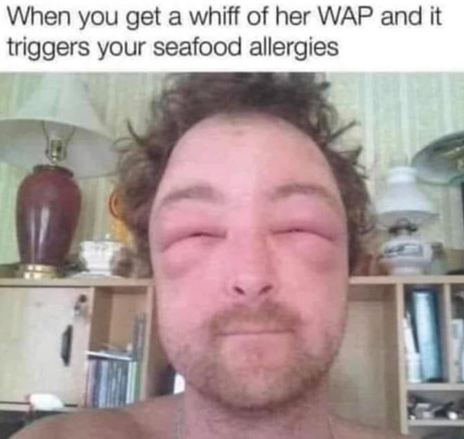 wap allergies.JPG