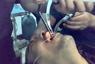 wrenchectomy.gif
